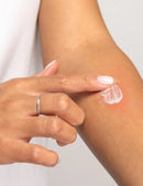 Kawakawa Skin Lotion